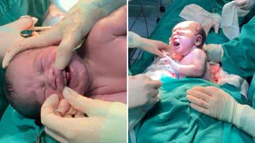 Bebê nasce com 'dentes' no MS e surpreende família - Reprodução/Instagram