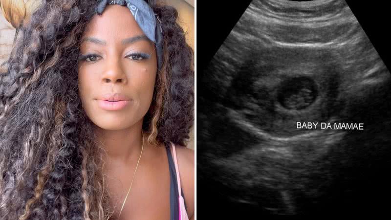 A ex-BBB Lumena Aleluia revela que sofreu aborto espontâneo neste domingo (12), Dia das Mães; confira o relato - Reprodução/Instagram