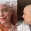 Após quimioterapia, Fabiana Justus celebra crescimento do cabelo: "Nascendo"