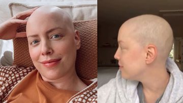 Após quimioterapia, Fabiana Justus celebra crescimento do cabelo: "Nascendo" - Reprodução/Instagram