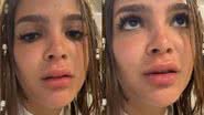 Mel Maia assusta fãs com boca inchada após acidente doméstico: "Deu ruim" - Reprodução/ Instagram