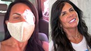 Gretchen passa por cirurgia de emergência problema oftalmológico: "Estou de tampão" - Reprodução/Instagram