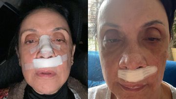 Ex-diretora da Globo sofre acidente e fratura o rosto: "Minha vida está preservada" - Reprodução/Instagram