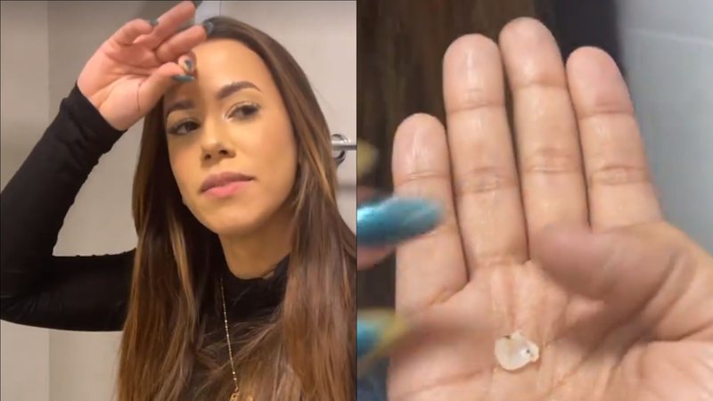 Ex-BBB Larissa Tomásia perde dente durante churrasco e surge 'banguela': "Caiu" - Reprodução/Instagram