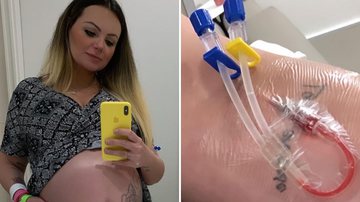 Ex-Mulher Pera enfrenta gravidez de risco e toma mais de 700 injeções: "Deus é bom" - Reprodução/Instagram