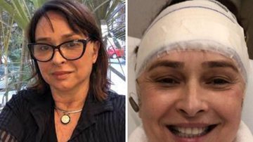 Myrian Rios explica retirada de dispositivos implantados na cabeça: "Recuperação fantástica" - Reprodução/Instagram