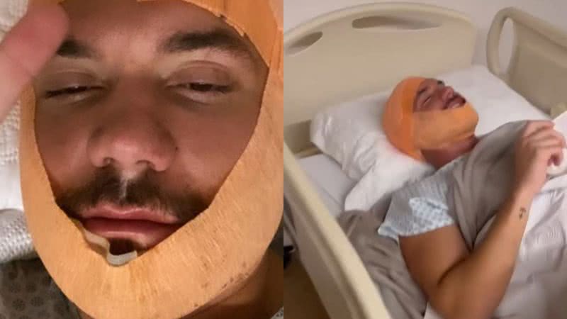 Eliezer mostrou seu pós-operatório após passar por uma cirurgia de implante capilar e de barba - Reprodução/Instagram