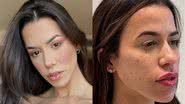 Ex-BBB Larissa Tomásia choca com resultado de harmonização facial - Instagram