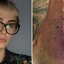Maria Casadevall apavora fãs ao mostrar perna destruída após acidente: "Olha e respira"