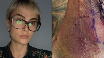 Maria Casadevall apavora fãs ao mostrar perna destruída após acidente: "Olha e respira" - Reprodução/Instagram
