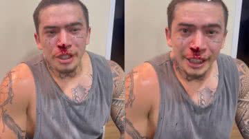 Whindersson Nunes surge com o rosto coberto de sangue após luta - Instagram