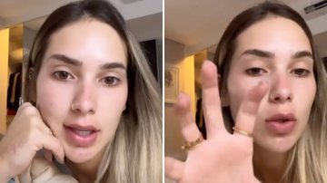 Grávida? Virgínia Fonseca esclarece uso de chip hormonal e dá novos detalhes - Reprodução/Instagram