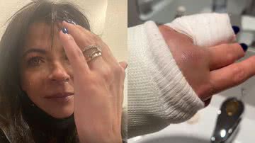Anna Lima tem dedo quebrado por instrutor durante passeio de esqui: "Deu um soco" - Reprodução/Instagram