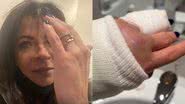 Anna Lima tem dedo quebrado por instrutor durante passeio de esqui: "Deu um soco" - Reprodução/Instagram