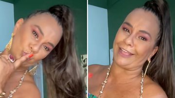 Solange Couto remove marca deixada pelo marido e desabafa: "Me superando" - Reprodução/TV Globo