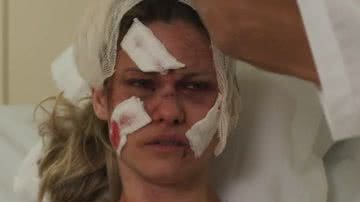 No hospital, a vilã ficará fora de si ao ver a situação do seu rosto depois do grave acidente; confira! - Reprodução/TV Globo