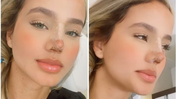 Abalada, Biah Rodrigues desabafa após complicações de cirurgia no nariz: "A gente faz cada besteira" - Reprodução/Instagram