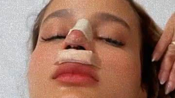 Biah Rodrigues passa por cirurgia para corrigir perfuração no nariz após rinoplastia - Reprodução/Instagram