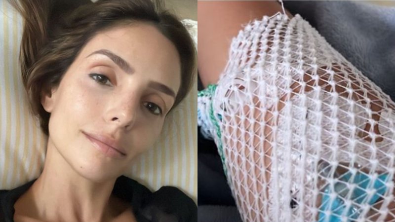 Carol Celico é internada com diagnóstico preocupante no intestino: "Muito forte" - Reprodução/Instagram