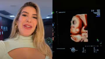 Gravidíssima, Lore Improta descobre rostinho da filha em ultrassom 4D e se choca com semelhança: "Cara de Léo" - Reprodução/YouTube