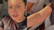 Maraisa mostra braço furado após tomar soro na veia para controlar crises de ansiedade: "Isso muda a vida" - Reprodução/Instagram