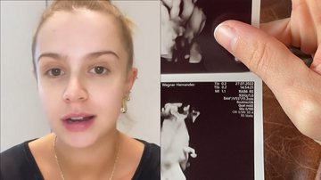 Na reta final, Isa Scherer mostra rostinho dos gêmeos em ultrassom 3D: "Apareceu" - Reprodução/Instagram