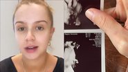 Na reta final, Isa Scherer mostra rostinho dos gêmeos em ultrassom 3D: "Apareceu" - Reprodução/Instagram