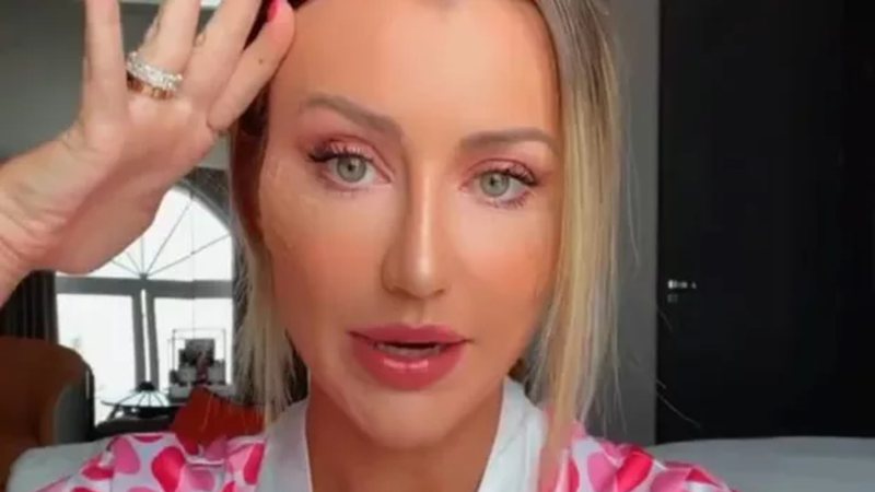 Ana Paula Siebert mostra curativos no rosto após procedimento estético - Instagram