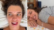 Bruna Linzmeyer mostra bumbum repleto de agulhas durante tratamento: "Me acompanham há 11 anos" - Reprodução/Instagram