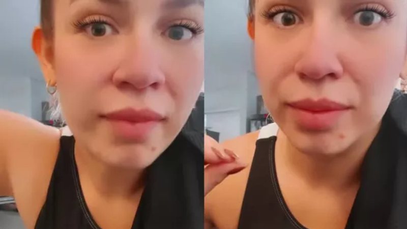 Marilia Mendonça relata problema com acne após iniciar uso de DIU - Instagram