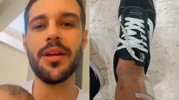 Ex-BBB Rodrigo Mussi mostra cicatrizes pela primeira vez - Reprodução/Instagram
