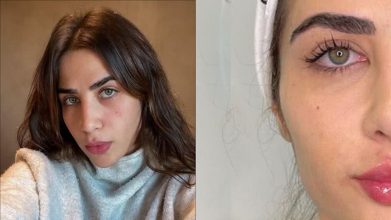 Filha de Leonardo faz harmonização facial e resultado impressiona: "Ficou linda" - Reprodução/Instagram