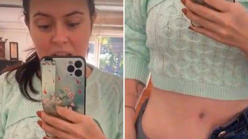 Mariana Bridi expõe cicatriz chocante após cirurgia delicada: "Fica inchado" - Reprodução/Instagram