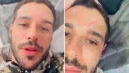 Rodrigo Mussi comove ao mostrar cicatriz após acidente: "Marca do milagre" - Reprodução/Instagram