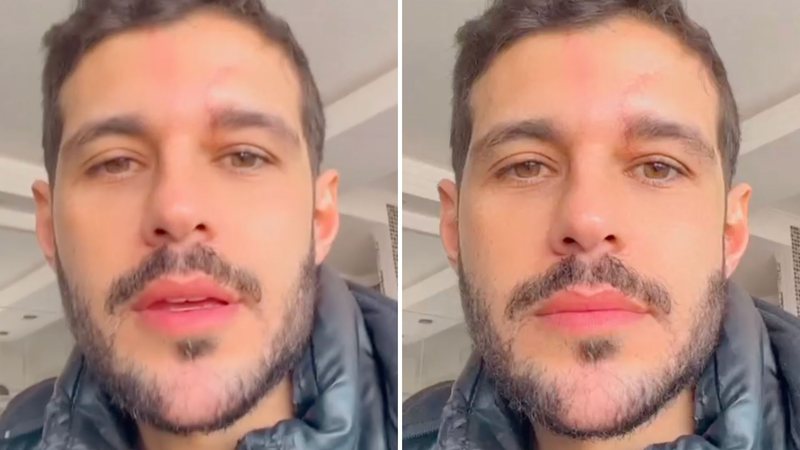 Ex-BBB Rodrigo Mussi diz que passou mal e ficou de cama após ir à primeira festa após o acidente: "Muito doente" - Reprodução/Instagram
