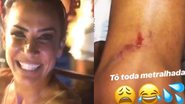 Após noite de folia, Scheila Carvalho mostra machucados: ''Olha a situação'' - Reprodução / Instagram