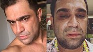 Evandro Santo é agredido após show e faz acusação de homofobia - Instagram