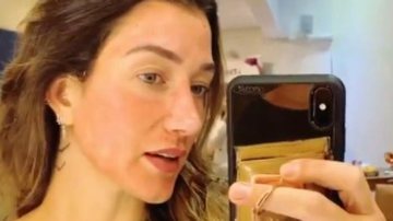 A blogueira mostrou rosto depois de passar por uma técnica de prevenção do melasma - Reprodução/Instagram