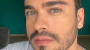 Careca, Sidney Sampaio passa por tratamento contra calvície - Instagram