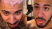 Kevinho sofre "acidente" e perde cabelos - Reprodução/Instagram