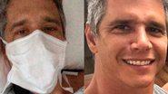 Marcio Garcia sofre acidente e passa por cirurgia - Reprodução/Instagram