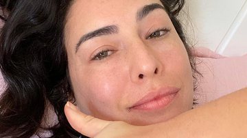 Fernanda Paes Leme tranquiliza fãs após passar por cirurgia delicada: "Foi tudo bem" - Instagram