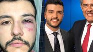 Matheus Ribeiro é agredido após reagir a assalto - Reprodução/Instagram