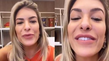Lorena Improta mostra antes e depois de preenchimento labial e botox - Arquivo Pessoal