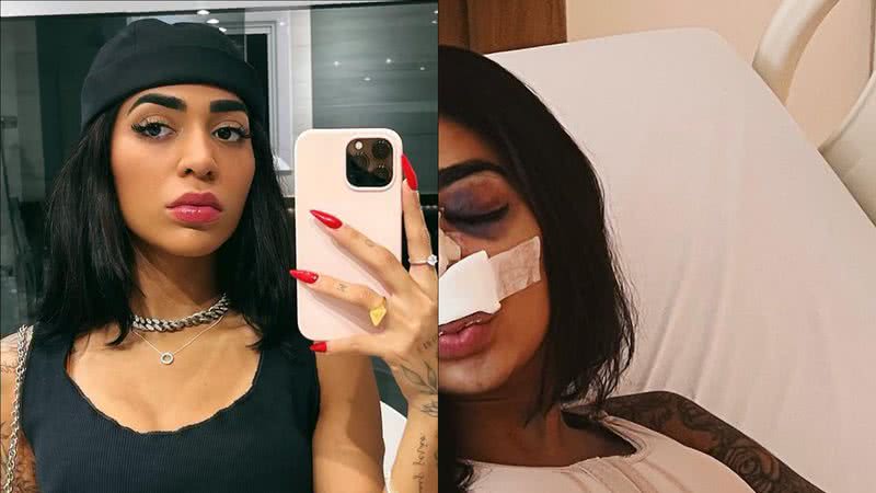Irmã de Gabigol assusta fãs ao surgir com rosto 'desfigurado': "Não entendi" - Reprodução/Instagram