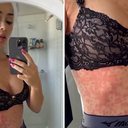 Ex-BBB Letícia Santiago surge toda inflamada e assusta fãs: "Esperando diagnóstico" - Reprodução/Instagram