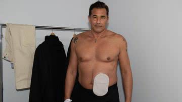 Luciano Szafir irá retirar sua bolsa de colostomia após 10 meses com o item em seu corpo - Reprodução/Instagram
