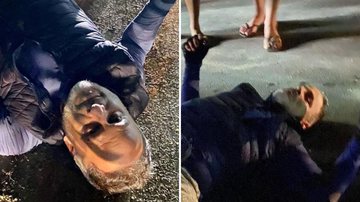 Marcos Breda exibe imagens assustadoras após acidente grave: "Fratura múltipla" - Reprodução/TV Globo