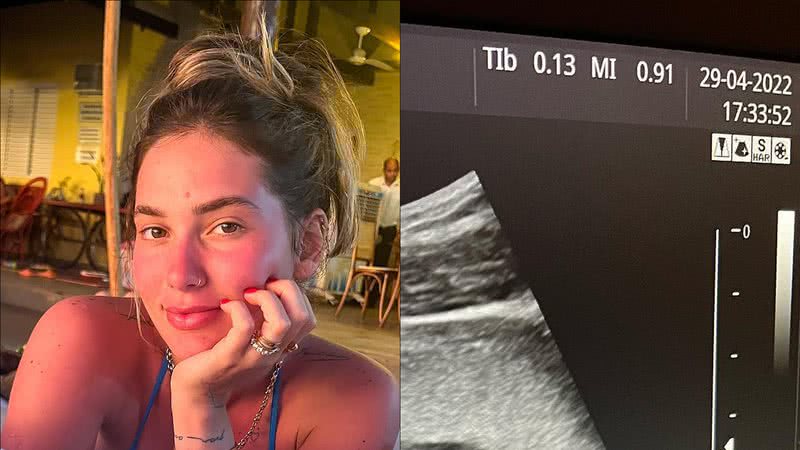 Aos três meses, Virgínia Fonseca mostra ultrassom e emociona web: "Já amo muito" - Reprodução/Instagram