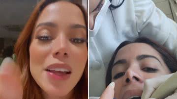 Anitta tira foto no dentista e exalta saúde no Brasil: "Não tem igual' - Reprodução/Instagram